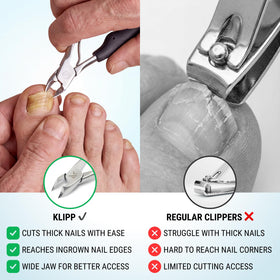 KLIPP Toenail Clippers with a hand demonstrating use