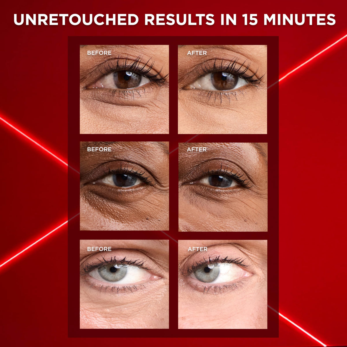 L'Oreal Paris Revitalift Eye Bag Eraser application on skin