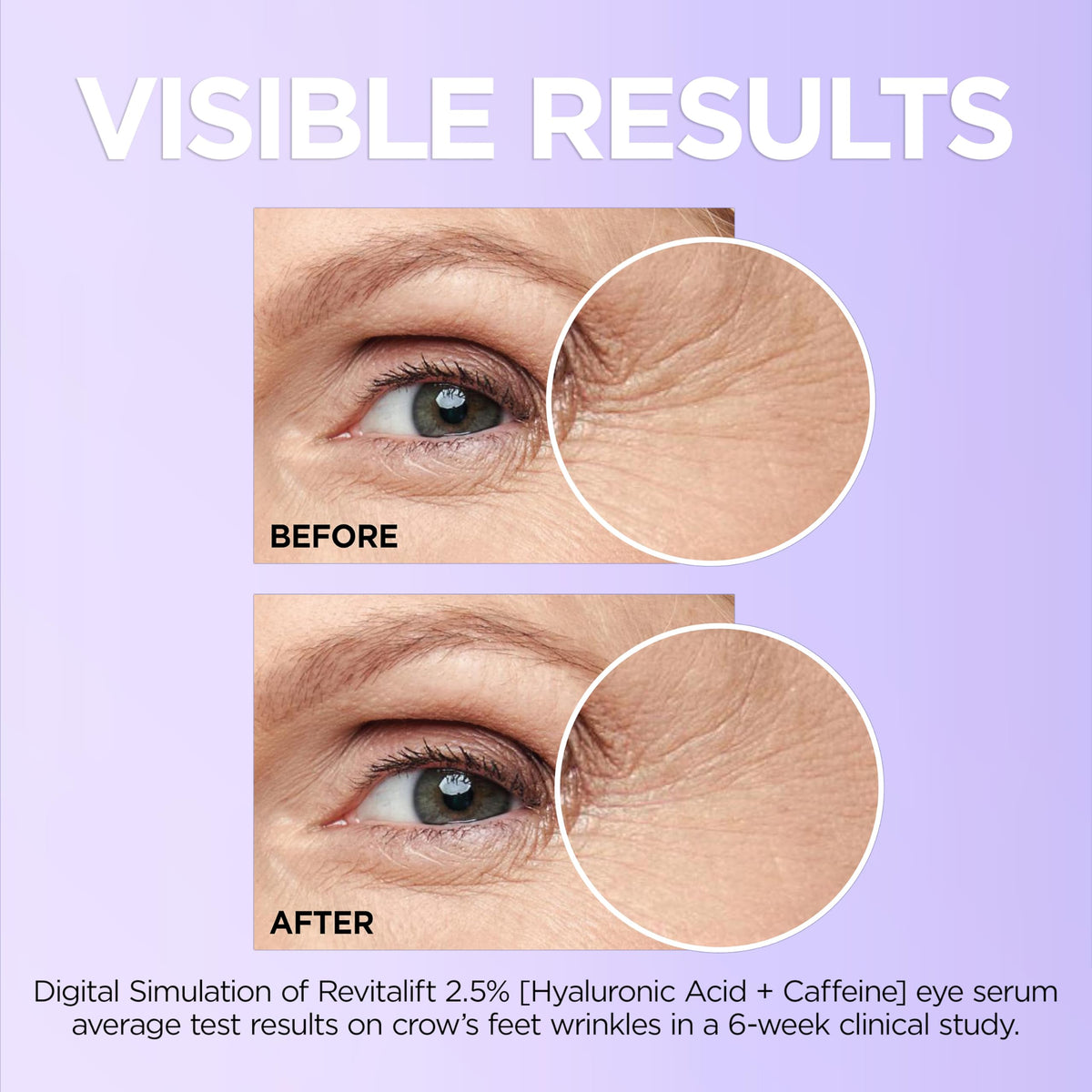 L'Oreal Paris Revitalift Eye Serum with cooling applicator