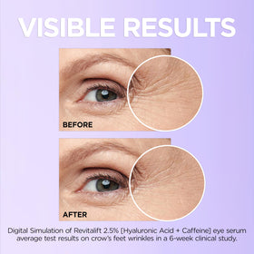 L'Oreal Paris Revitalift Eye Serum with cooling applicator