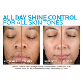 La Roche-Posay Acne Skin Care Set packaging