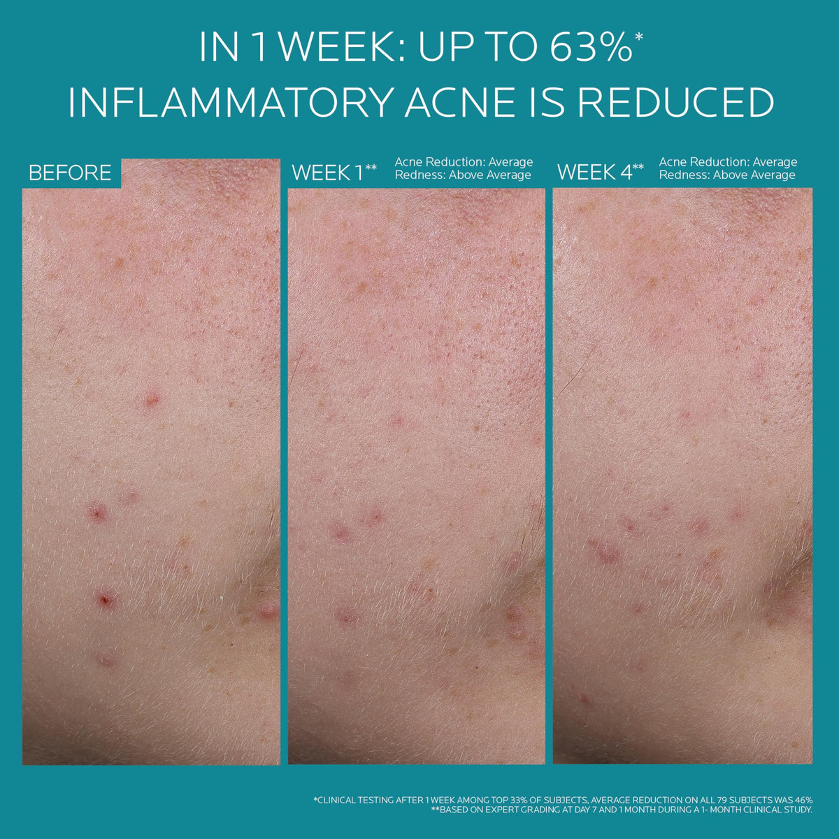 La Roche-Posay Effaclar BPO Multi-Target Acne with ingredients list