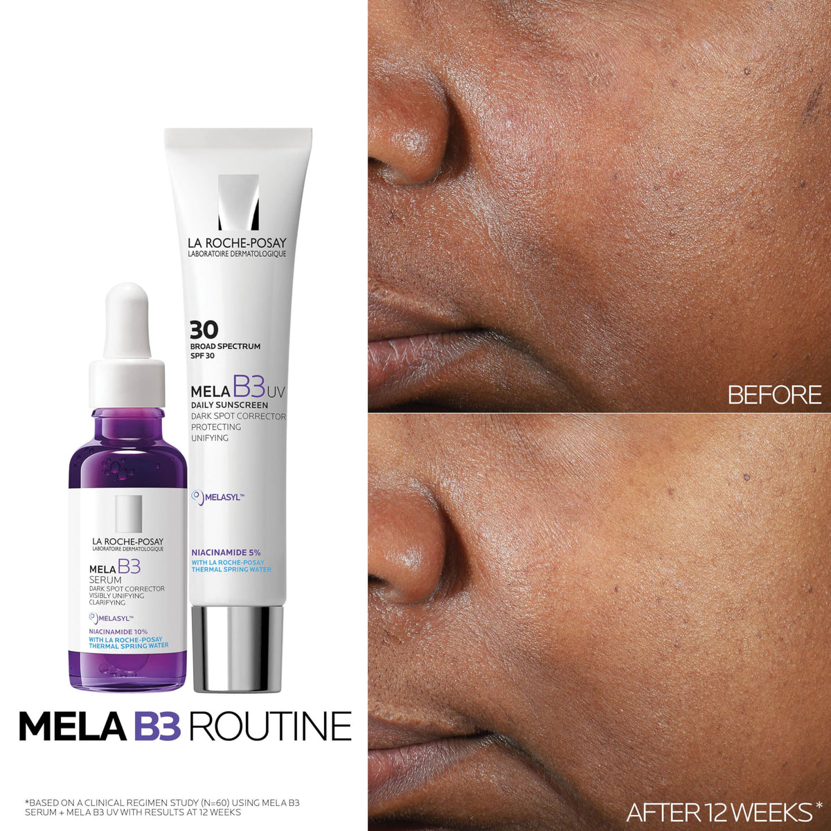 La Roche-Posay Mela B3 Dark Spot Serum 30ml with skincare products