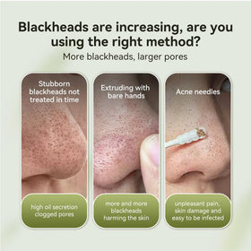 LANBENA Blackhead Remover Nose Strips in use on a model