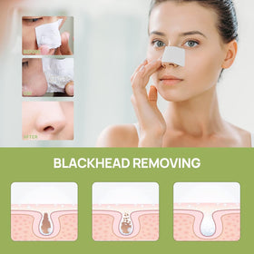 LANBENA Blackhead Remover texture close-up