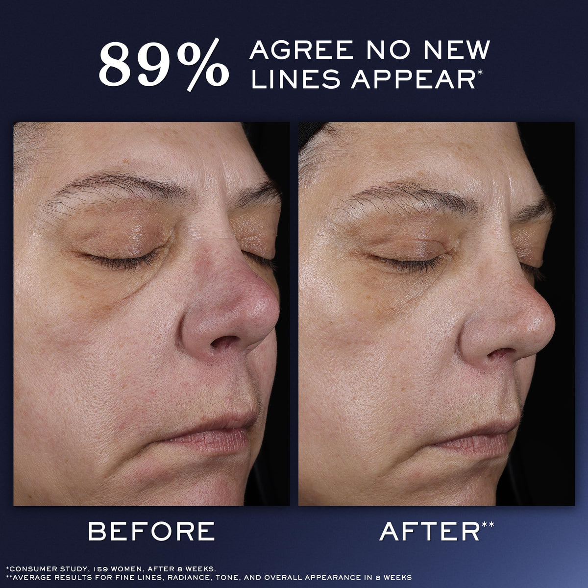 Lancôme Génifique Ultimate Recovery Serum texture close-up