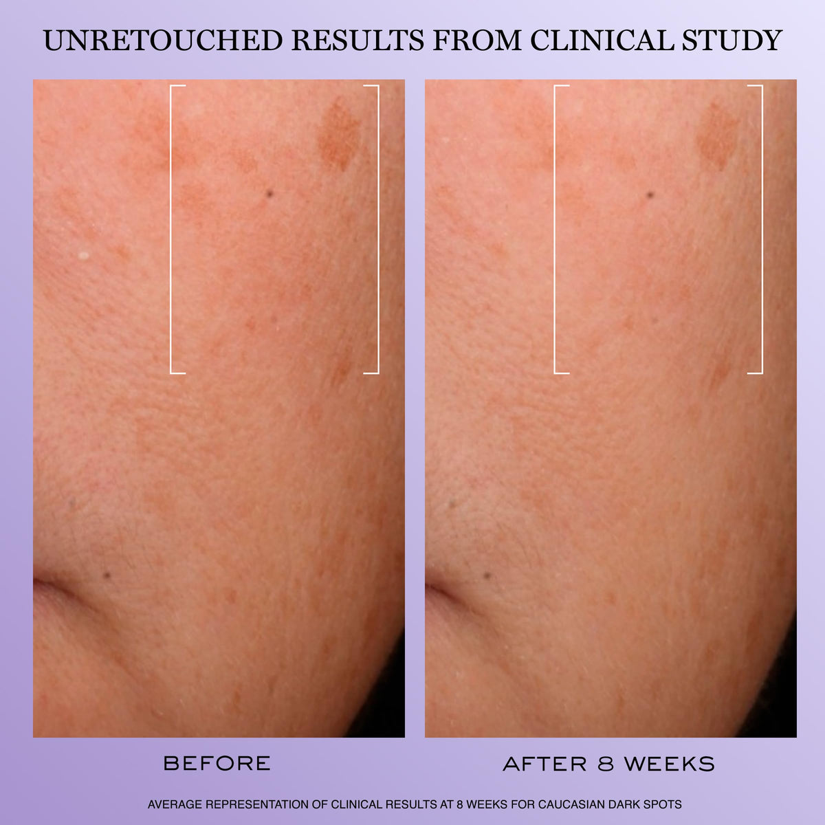 Lancôme Rénergie H.C.F. Triple Serum 20ml packaging