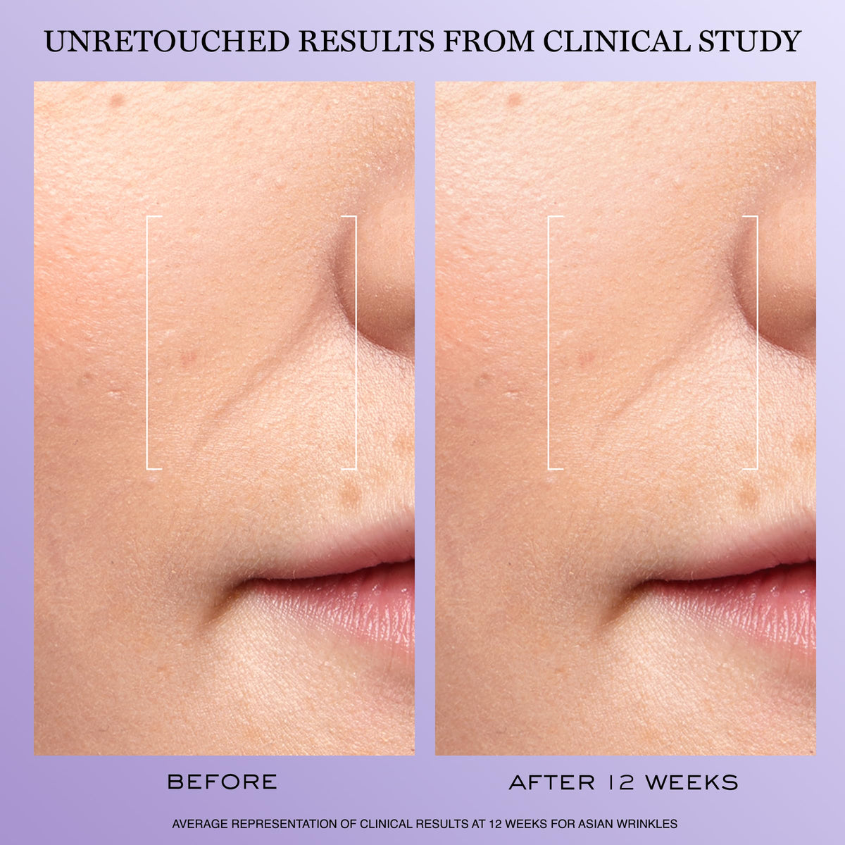 Lancôme Rénergie H.C.F. Triple Serum 20ml side view