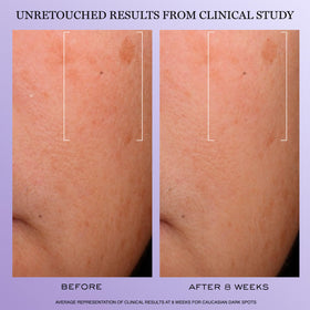 Lancôme Rénergie H.C.F. Triple Serum side view showing texture