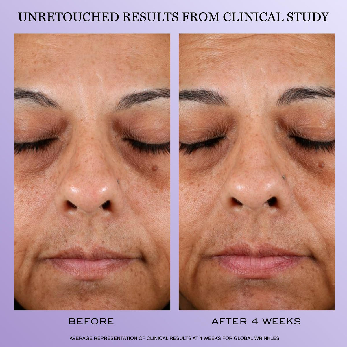 Lancôme Rénergie H.P.N. 300-Peptide Cream side view