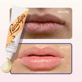 Lanolips 101 Multipurpose Ointment in a lifestyle setting