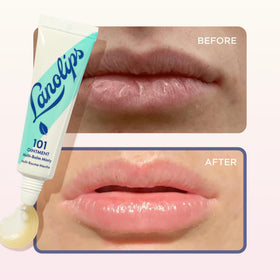 Lanolips 101 Multipurpose Ointment on cuticles for hydration