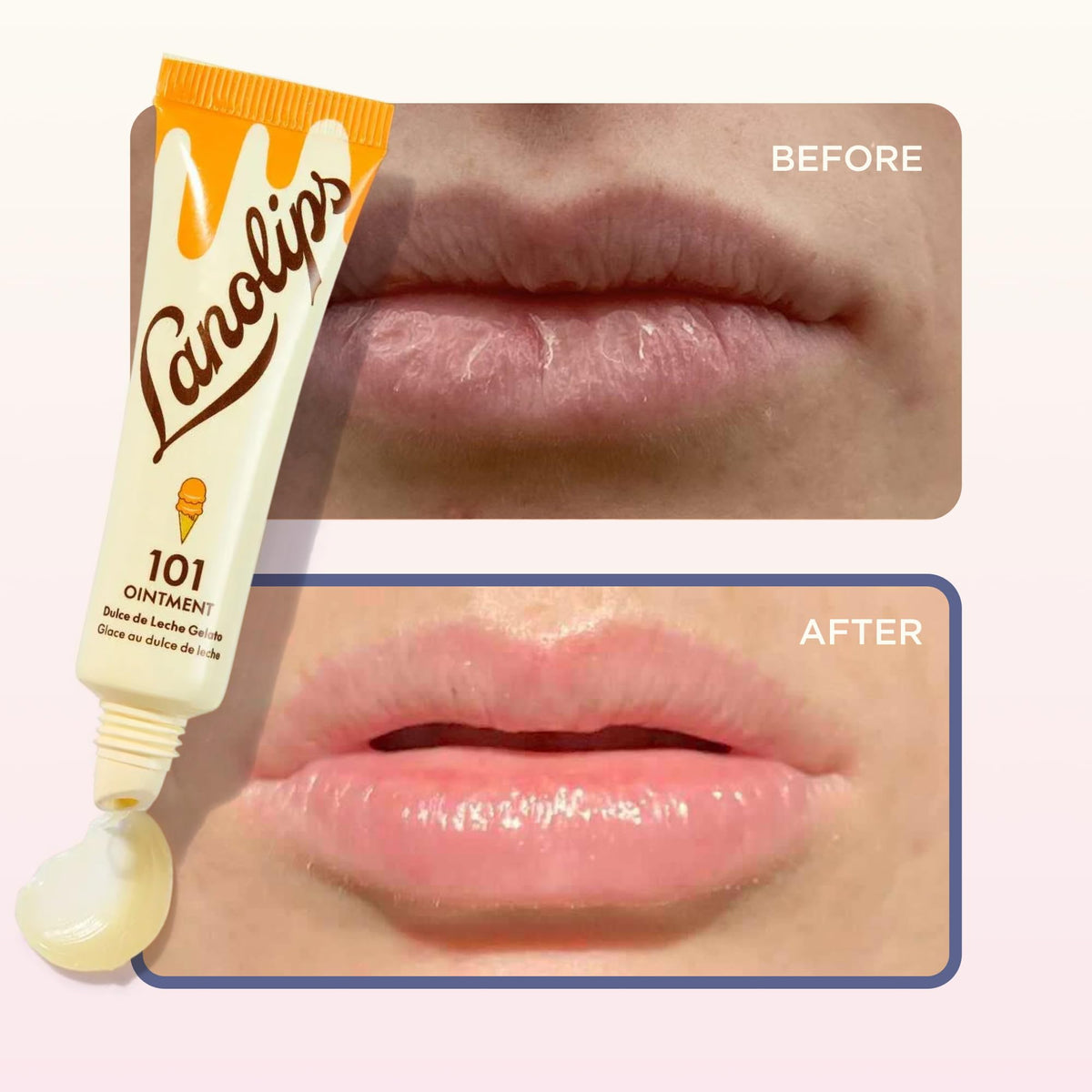 Lanolips 101 Ointment application on cuticles