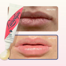 Lanolips 101 Ointment Watermelon with natural ingredients