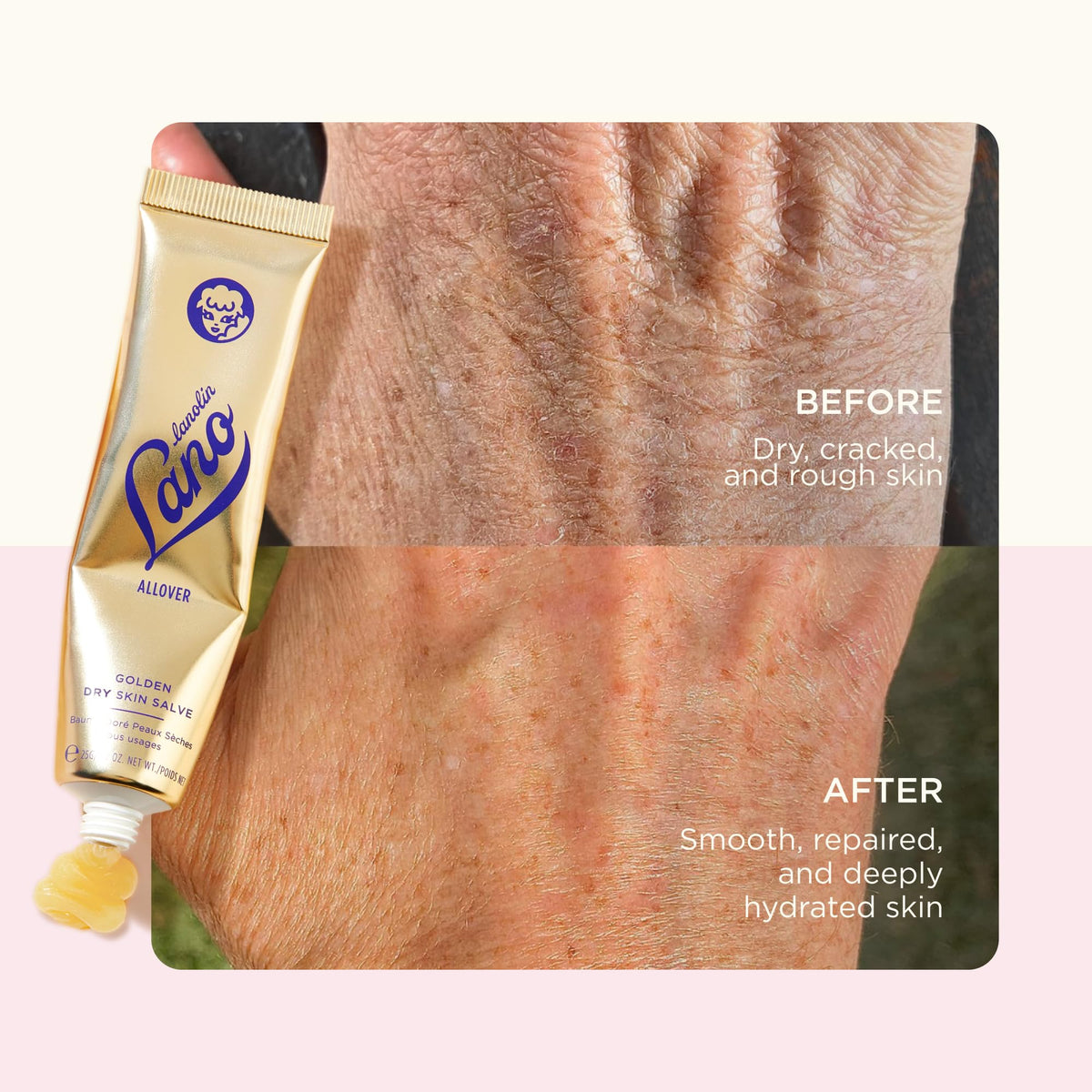 Lanolips Golden Dry Skin Salve 25g next to lip care products