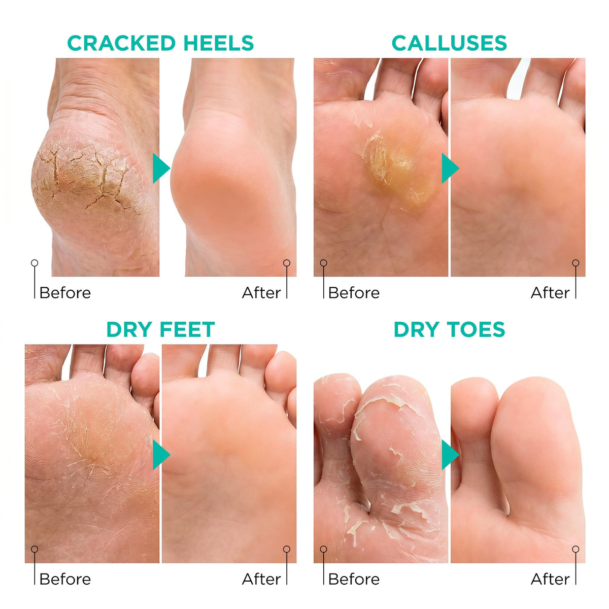 Lavinso Foot Peel Mask application on feet in a bath