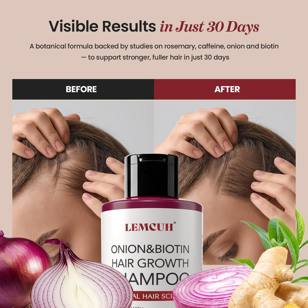 Lemcuh Hair Growth Shampoo with natural ingredients