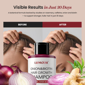 Lemcuh Hair Growth Shampoo with natural ingredients