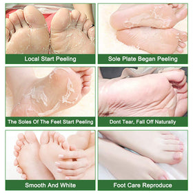 Liefiet Foot Peeling Mask worn on feet for exfoliation
