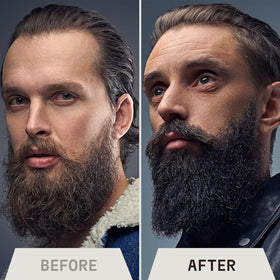 Lifestyle image of a man applying Striking Viking Beard Oil