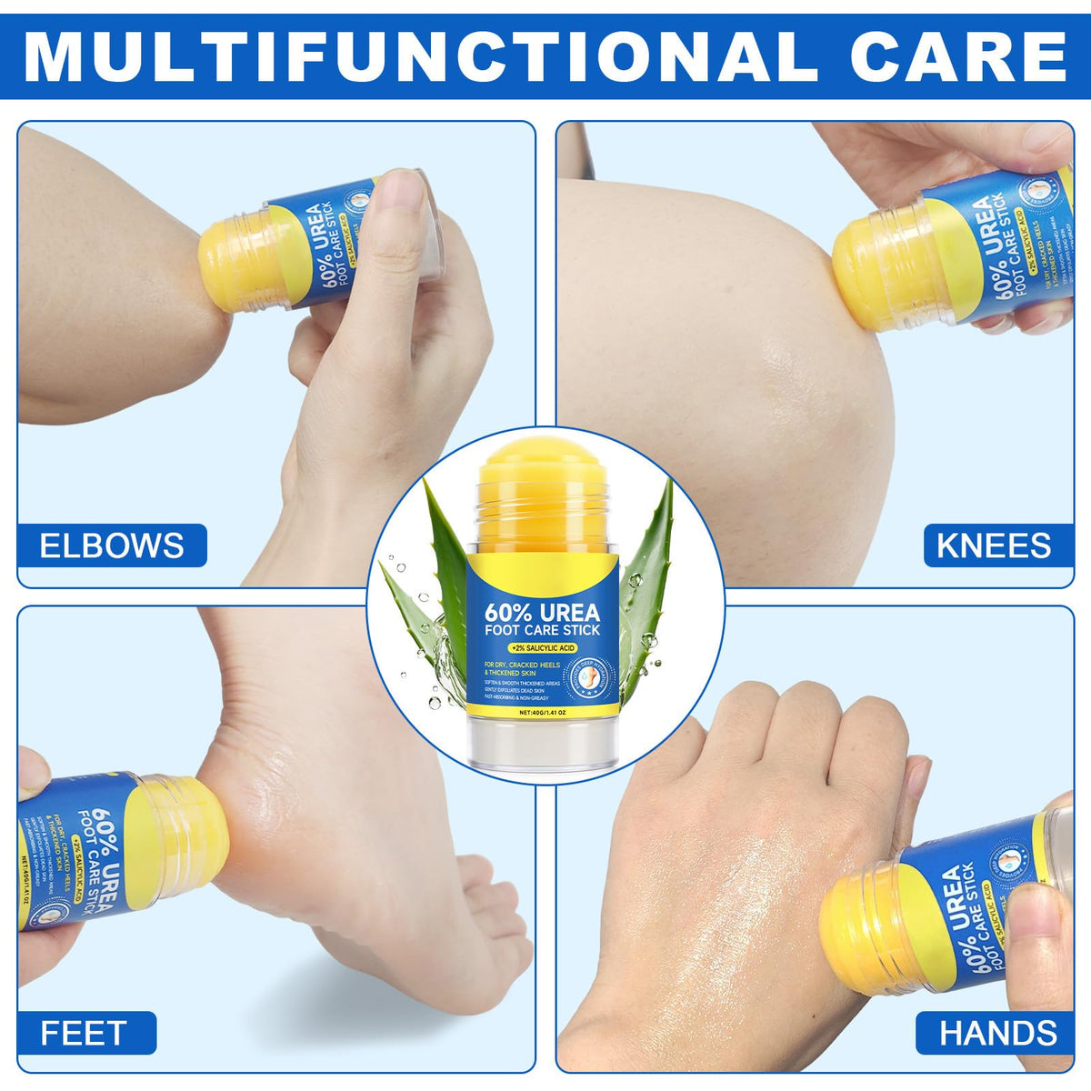 Lifestyle image of using 60% Urea Cream on feet