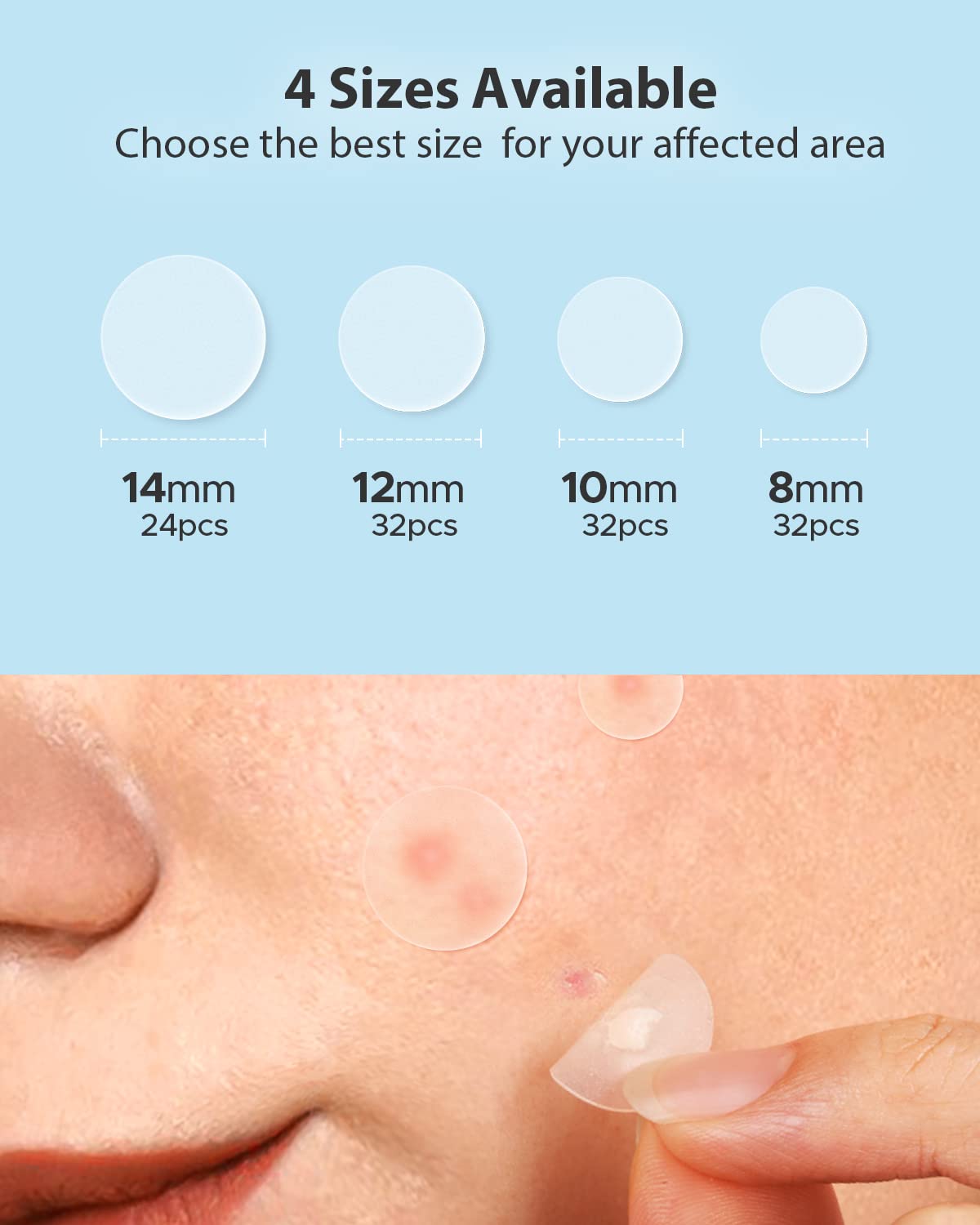 Lifestyle scene of LitBear Acne Pimple Patches in use