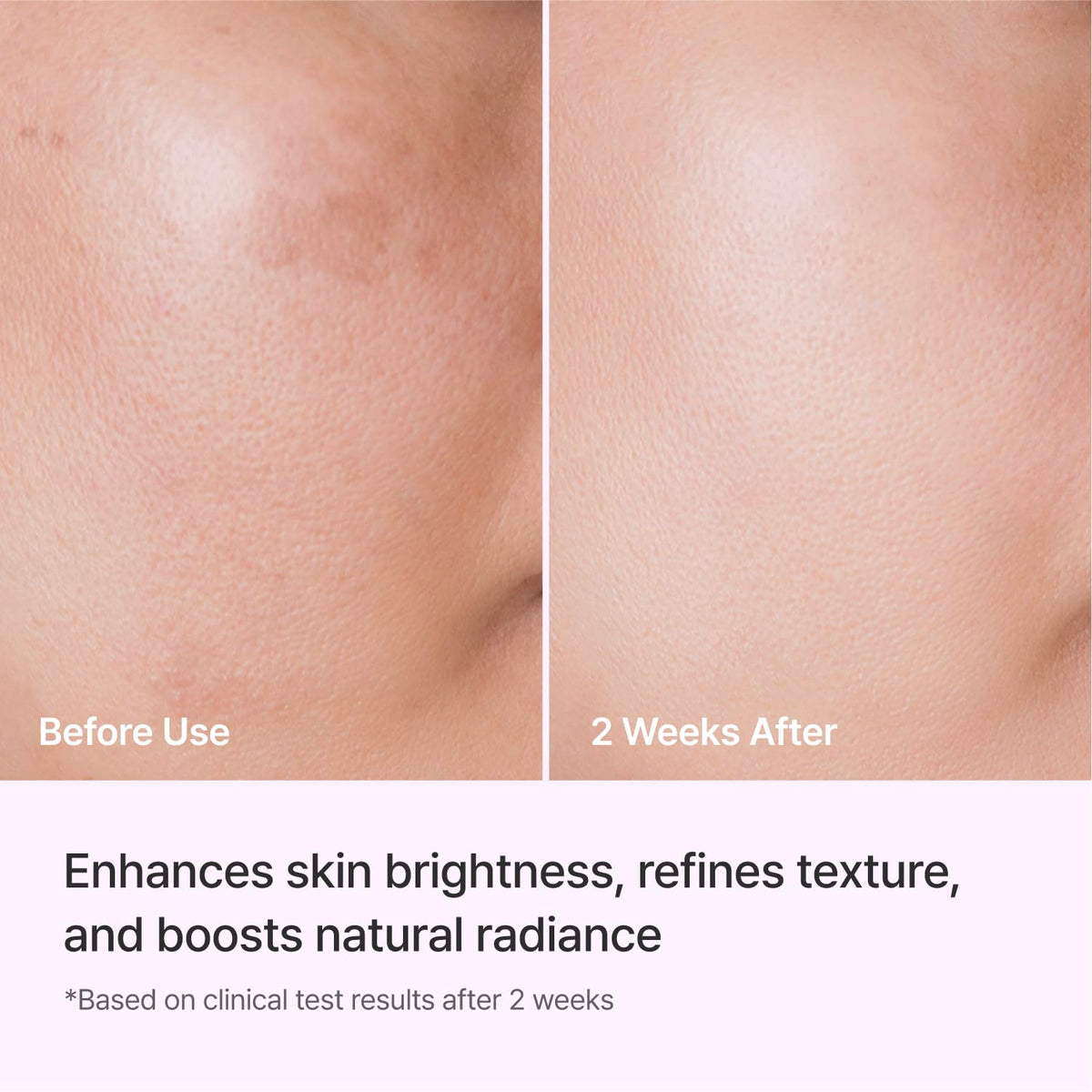 Lifestyle shot of REJURAN Triple Radiance Ampoule 50ml on a vanity