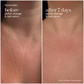 Lifestyle shot of THISWORKS Perfect Cleavage & Neck Serum in a bathroom