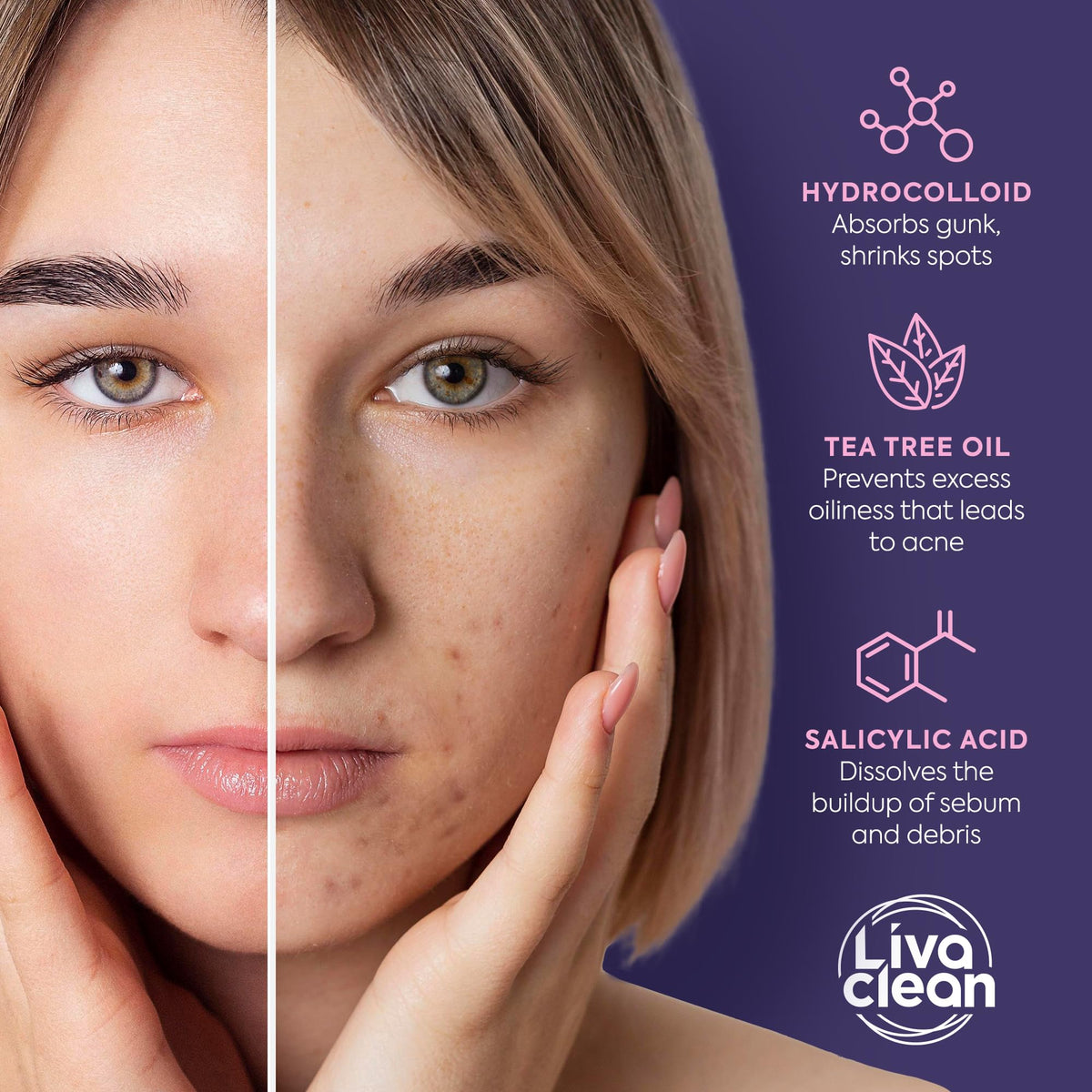 LivaClean Star Pimple Patches showing easy-to-peel sheets