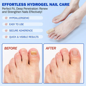 LTQXGT Toenail Care Patches displayed with a nail care routine