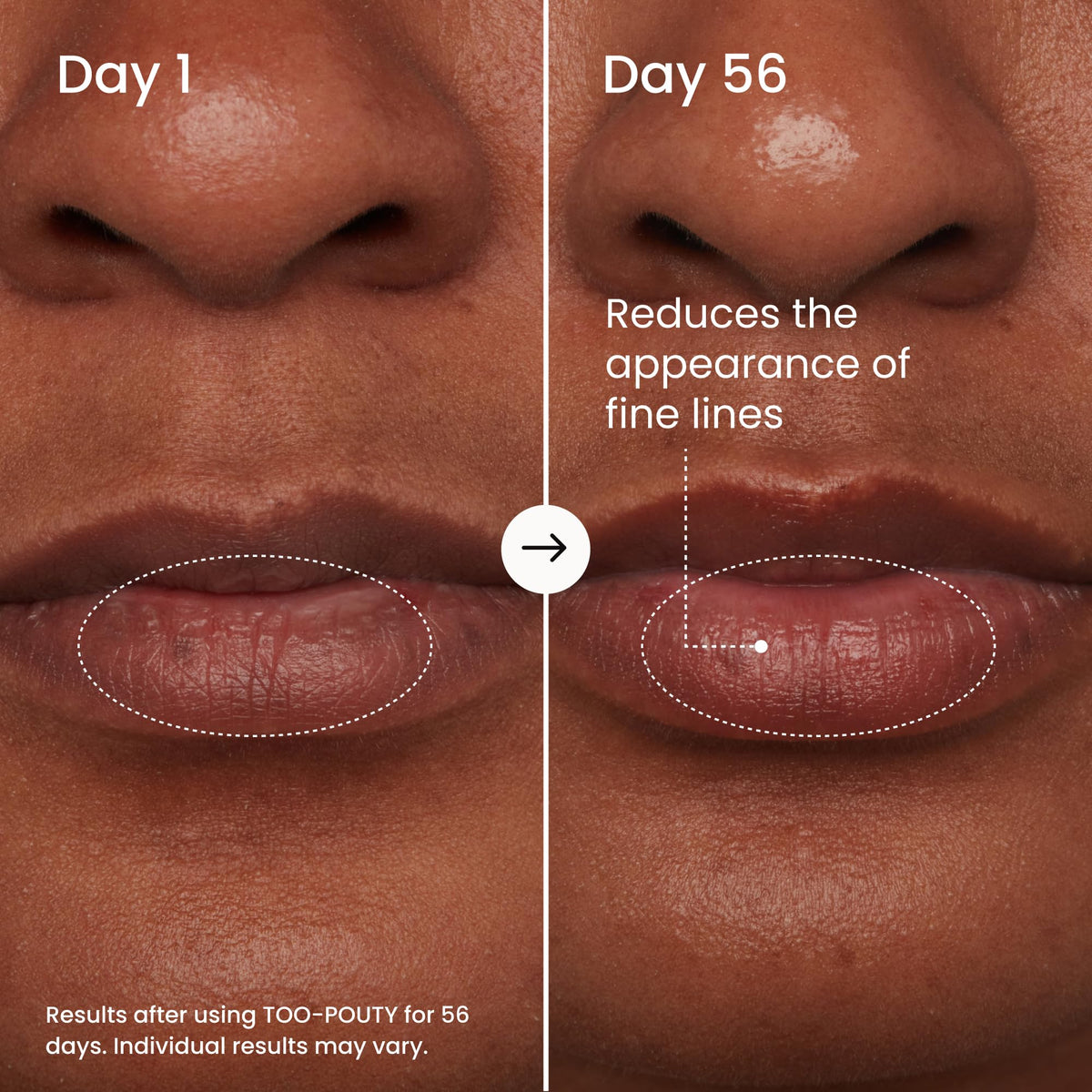 MAËLYS TOO-POUTY Lip Plumping Mask with other beauty products