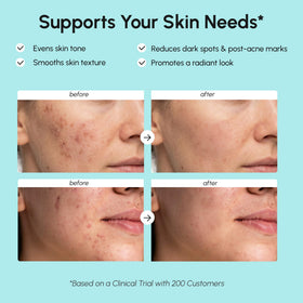 MAREE Azelaic Acid Face Cream 15% texture close-up