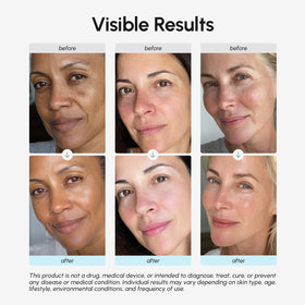 MAREE Face Moisturizer Retinol Cream side view