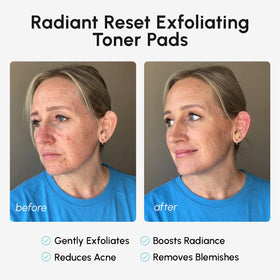 MAREE Glycolic Acid Pads on a bathroom counter