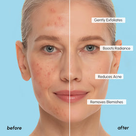 MAREE Glycolic Acid Pads with tea tree oil and vitamins