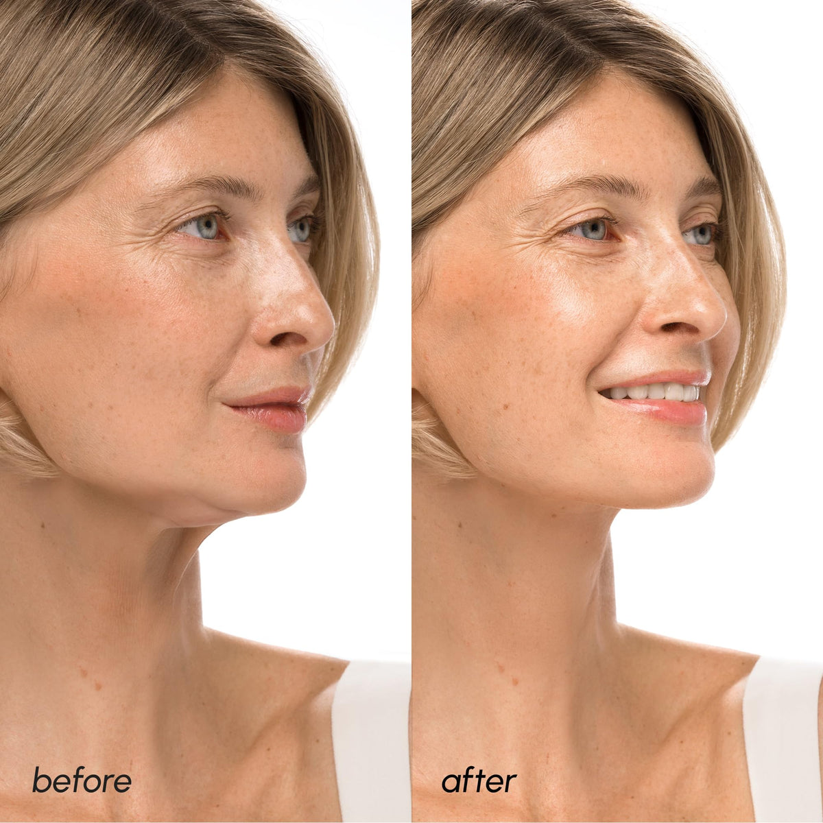 MAREE V Line Lifting Mask with ingredients displayed