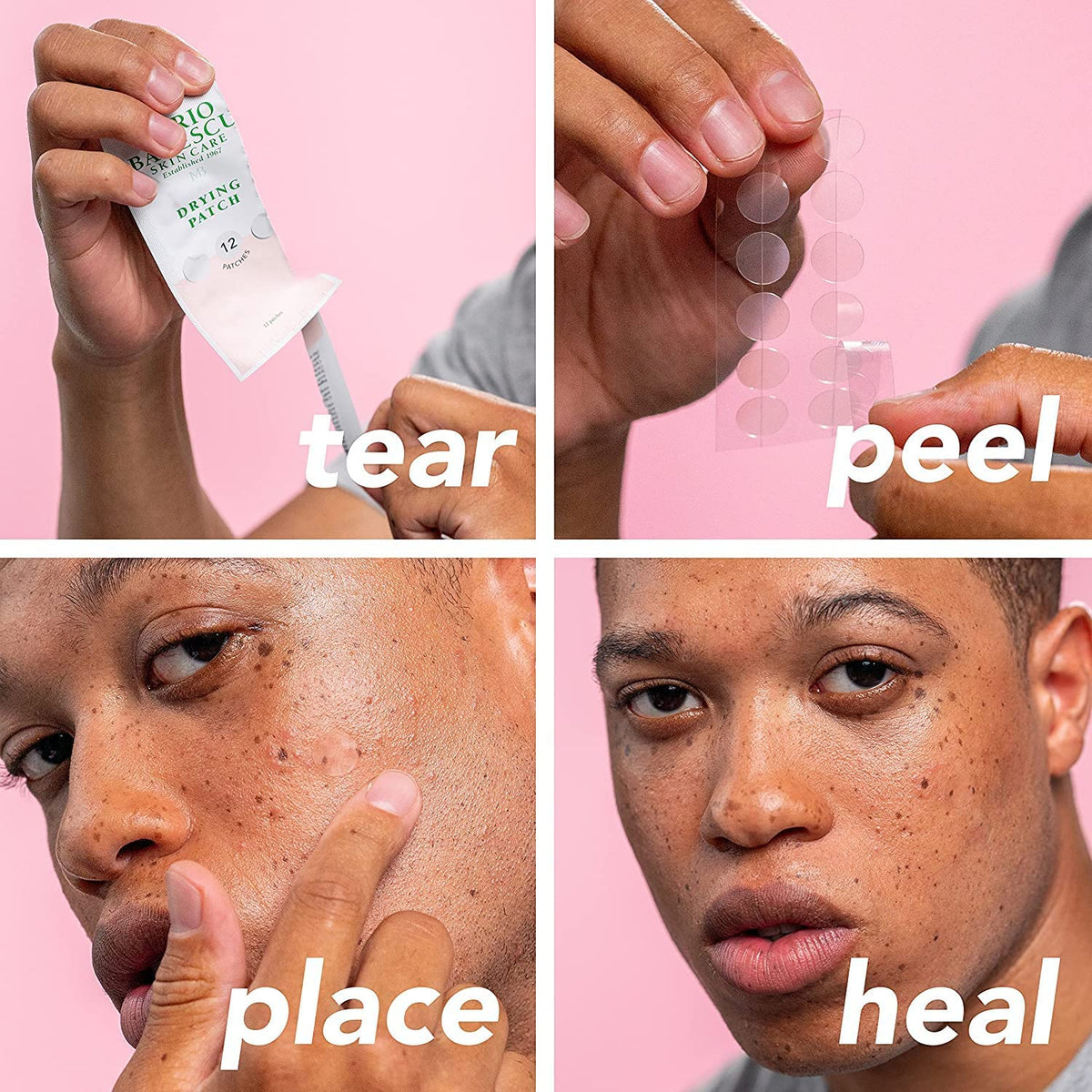 Mario Badescu Drying Patches in use on skin