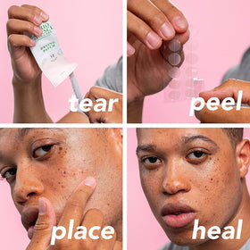 Mario Badescu Drying Patches in use on skin