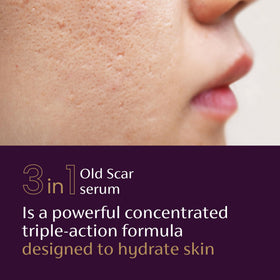 Mederma Scar Serum lifestyle scene on bathroom counter