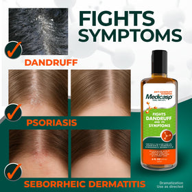Medicasp Coal Tar Anti-Dandruff Shampoo in a bathroom setting