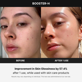 medicube Age-R support-H in use on a model's face