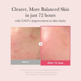 medicube TXA & Niacinamide 15% Glow Serum side view