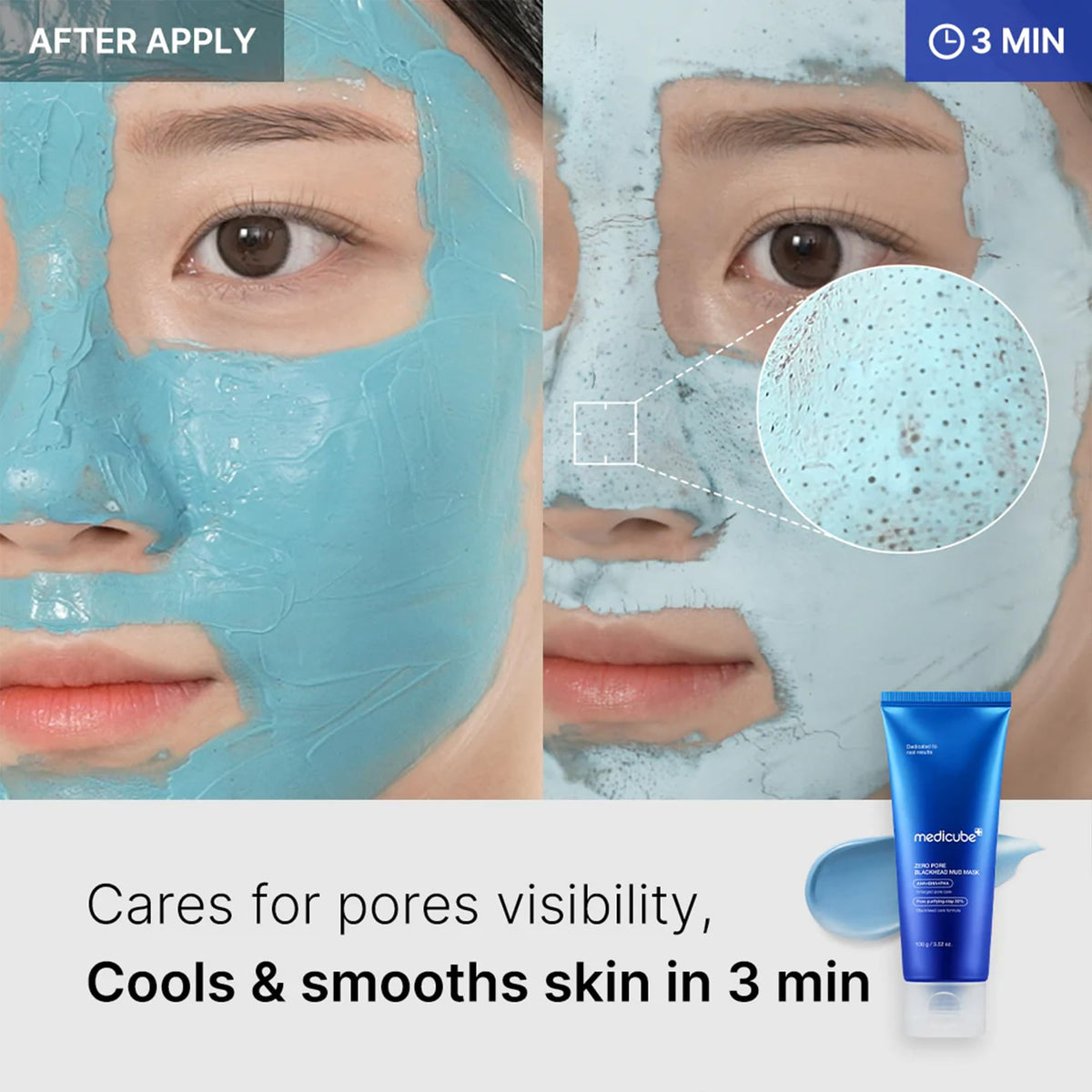medicube Zero Pore Blackhead Mud Mask application on skin