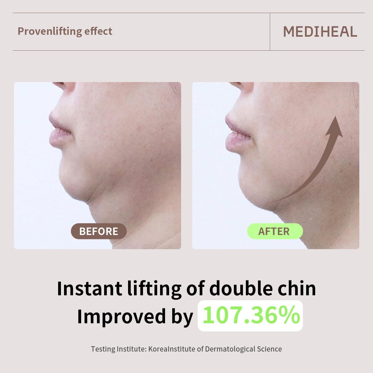 MEDIHEAL mask being applied in a skincare routine