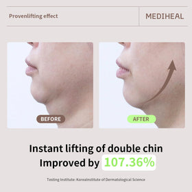 MEDIHEAL mask being applied in a skincare routine