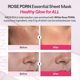 MEDIHEAL Rose PDRN Essential Face Sheet Mask in use with essence