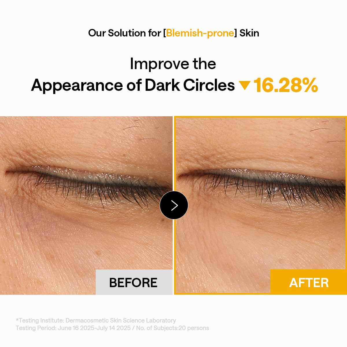 MEDIHEAL Vitamin C Collagen Eye Patches displayed on a skincare shelf