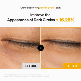 MEDIHEAL Vitamin C Collagen Eye Patches displayed on a skincare shelf