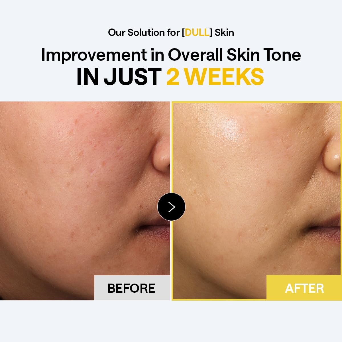 MEDIHEAL Vitamin C Toner Pad in use on skin