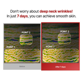 MEDITHERAPY Wrinkle-fit Neck Mask in use with facial roller